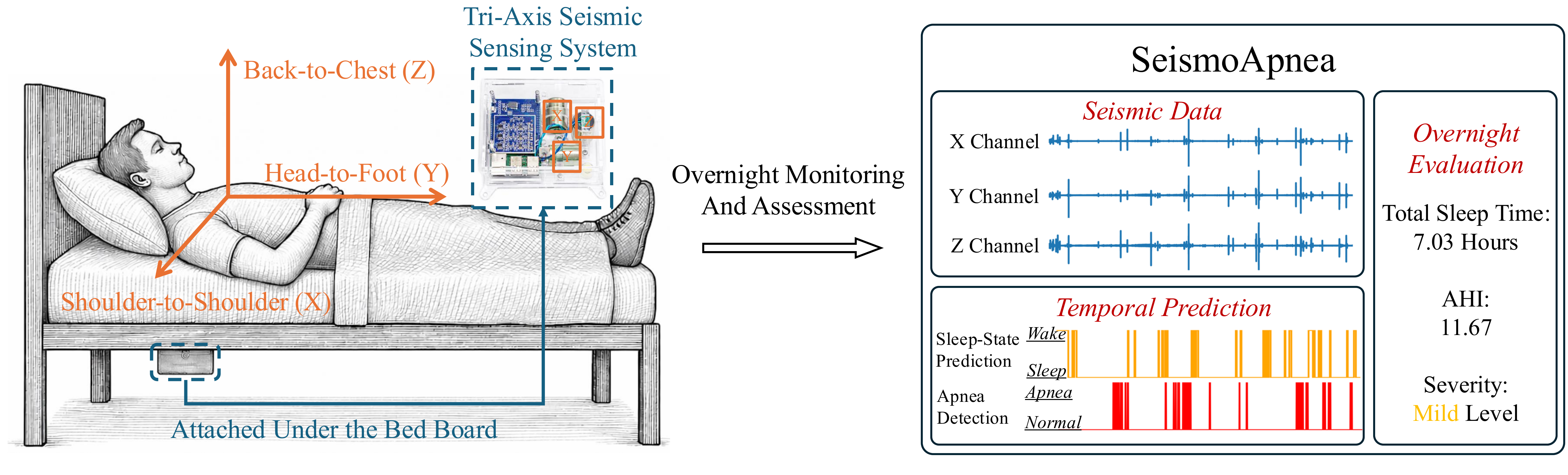 Sleep apnea monitoring principle illustration